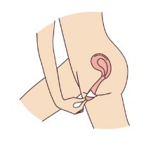 how to use menstrual cup 4